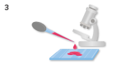 Carrying out the Outlook test on a drop of cord blood