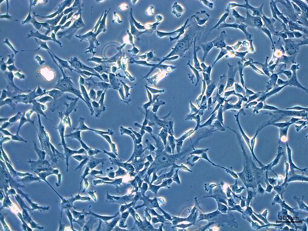 Differentiation blog image 1