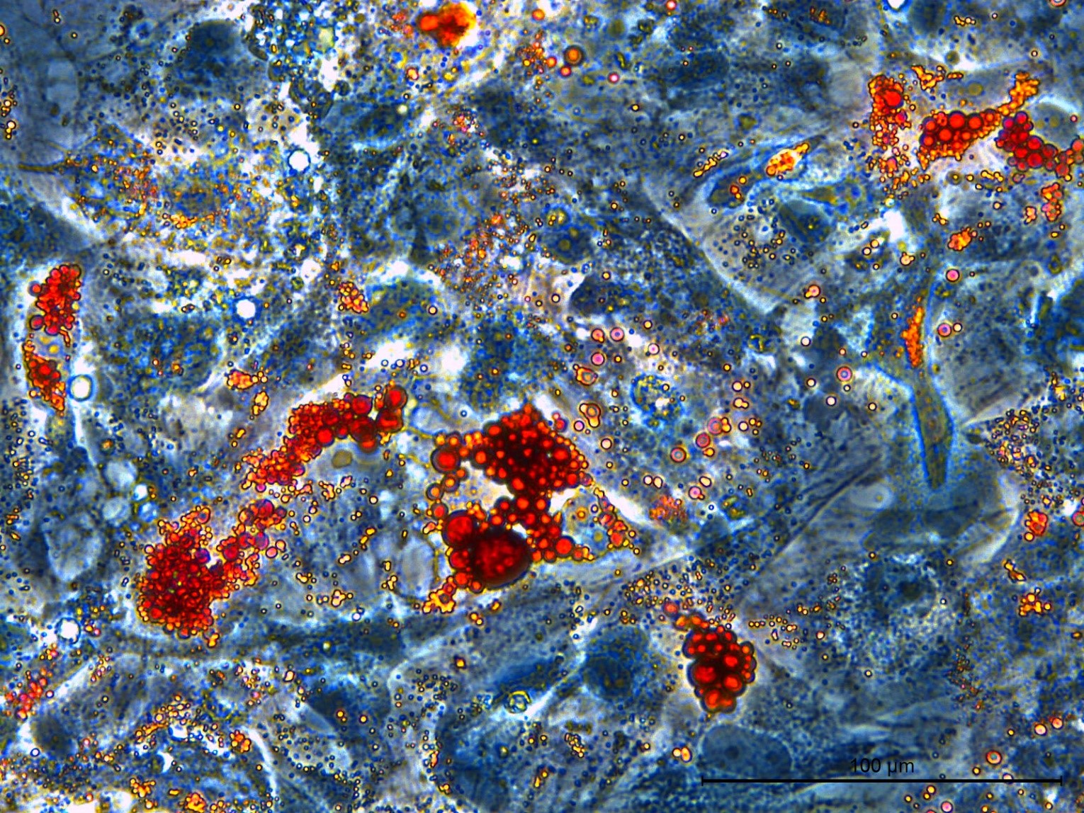 Differentiation blog image 3