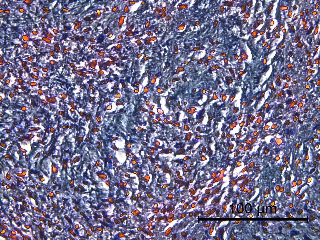 Differentiation blog image 5